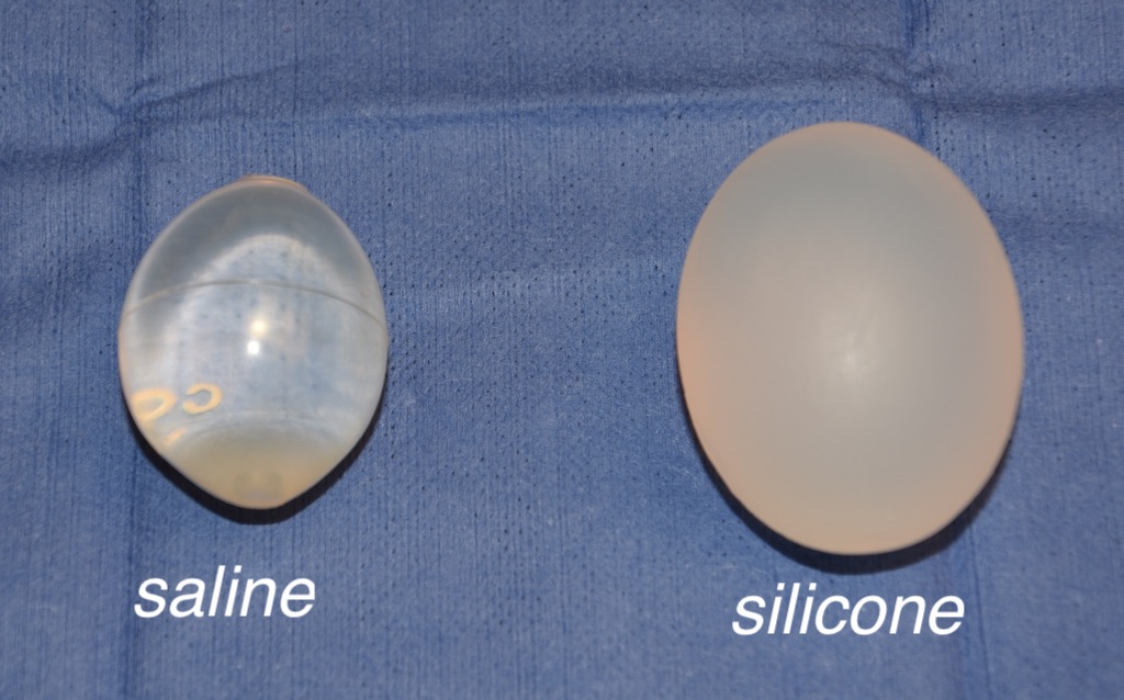 What Are My Options To Replace Hard Undersized Saline Testicle Implants